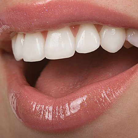 Cosmetic dentistry in Vijayawada